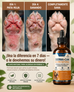 DERMACAN